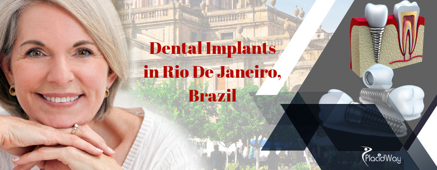 Dental Implants in Rio De Janeiro, Brazil